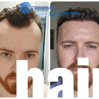 Update on Derek from Ireland showing his amazing transformation after only 7 months 

Check the itin