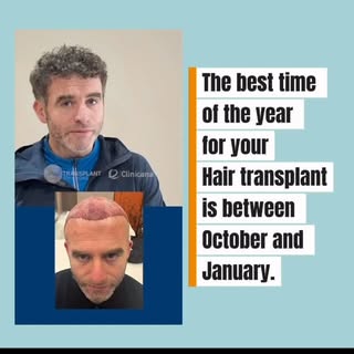 The best time of year for your hair transplant is between October and January.

Why? Because during 