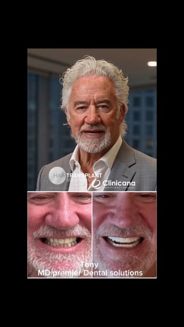 🦷 WHY I DECIDED TO MOVE INTO DENTAL

For many years, I’ve built Hair Transplant Solutions around on