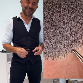 C'est toujours fabuleux de voir une nouvelle technique  arriver en Tricopigmentation🙏

Cependant il