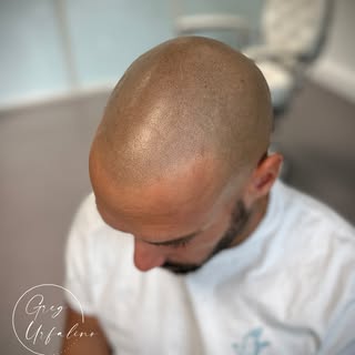 Indétectable, indécelable, naturel, réaliste...🤩

Autant d'adjectifs qui se marient à la Tricopigme
