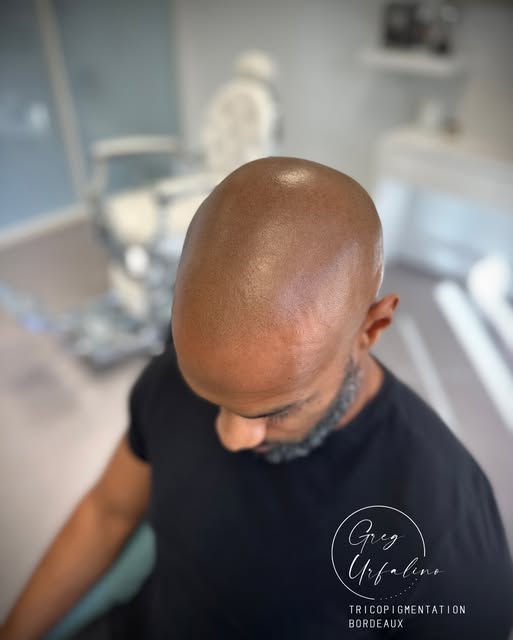 Vous pourriez trouver ça léger comme résultat de Tricopigmentation.

D’un point de vue professionnel