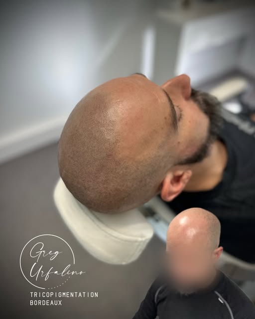 L'harmonie  est un élément essentiel en Tricopigmentation.
🙏😍
D’où l’intérêt d’avoir plusieurs séa