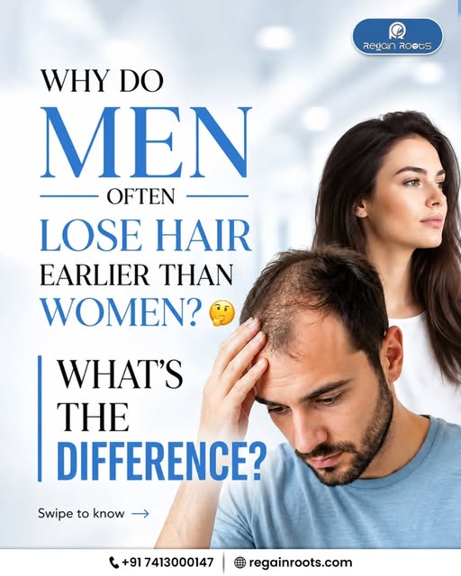 Men vs Women: Hair Loss Ka Pattern Alag Ho Sakta Hai - But Solution Possible Hai.

Men mein hairline