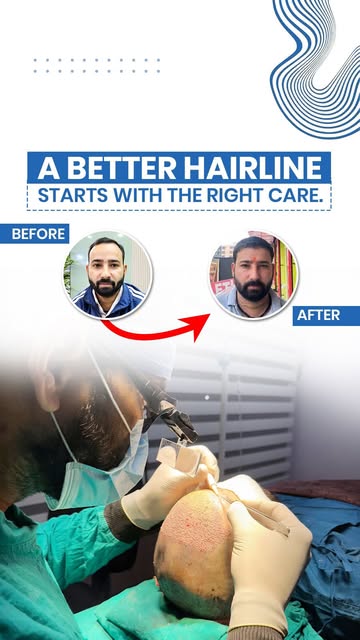 Hairline and density concerns can affect more than just appearance. With the right treatment and per