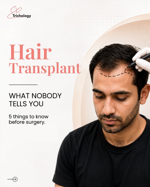 A hair transplant is not just about adding more hair — it’s about planning for the hair you have now