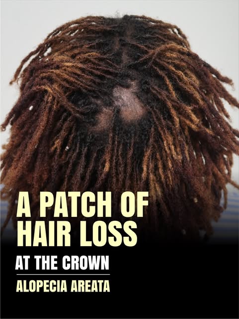 Ready to restore your hair and close those gaps? 

Call us at +254 735 559562 / 722 779027 to book y