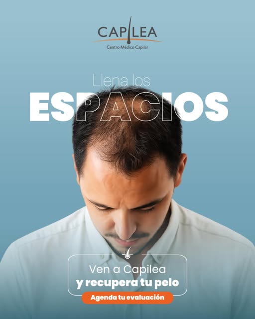 ¿Tu cabello está perdiendo densidad? Es momento de actuar. 🧑🏻‍🦱✨

No tienes que acostumbrarte a l
