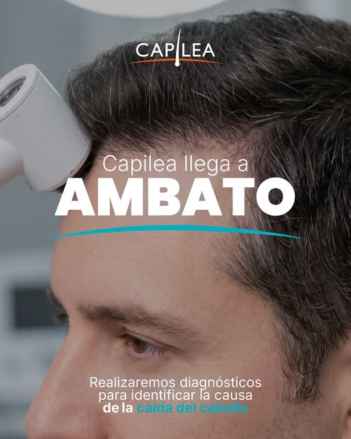 AMBATO | 3 DE OCTUBRE

¿Notas que tu cabello se está cayendo más de lo normal? 🧑‍🦱

No todas las c