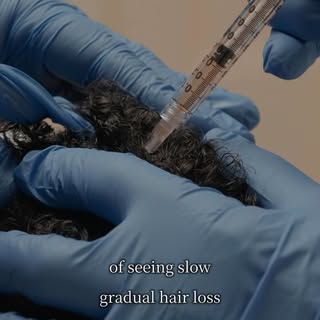 Hair loss can show up months after the trigger of the root cause.

Once people notice hair loss, the