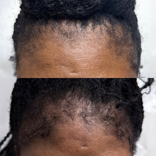 Yes, this is real.

Yes, this was done naturally.

Yes, this is the Dr. G Hair Restore Protocol.

Ca