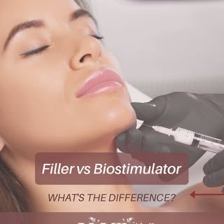 Filler vs. Biostimulator: What's the Difference?

Not every injectable works the same way—and choosi