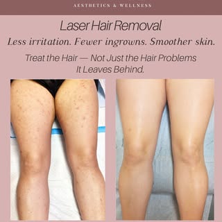 Treat the Hair — Not Just the Hair Problems It Leaves Behind.

Say goodbye to constantly dealing wit