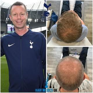 David Howells, former professional footballer of Tottenham Hotspur and  FA Cup winner, chose Hair Me