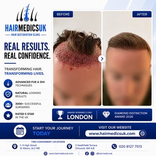 REAL RESULTS. REAL CONFIDENCE.

Ready to restore your hair and your confidence?

At Hair Medics UK, 