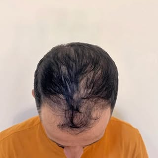 Antes de tratar o cabelo, nós tratamos a causa.

E quando o tratamento é individualizado, o resultad