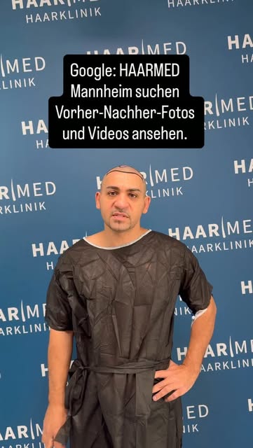 Du denkst über eine Haartransplantation nach? 
Sind deine Haare am Oberkopf oder im Tonsurbereich dü