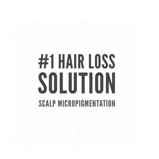 Scalp Micropigmentation is an innovative, non-invasive technique for camouflaging hair loss in men a
