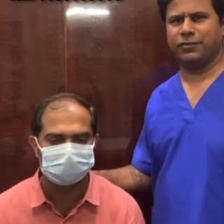 #fuehairtransplant