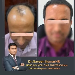 #hairtransplant #fuehairtransplant #saphirefue 
Here’s a post idea for Instagram:

“Get back your co