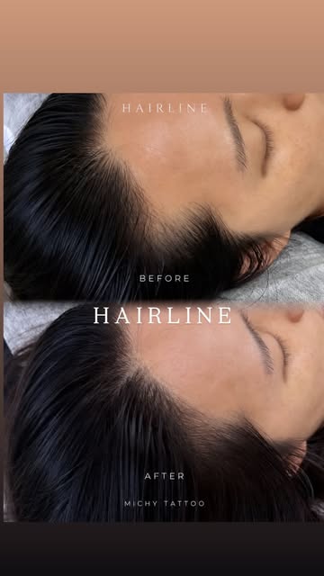 A little more fullness, a beautifully natural hairline 🖤🖤

M Hairline by MICHY TATTOO
📍 Los Angel