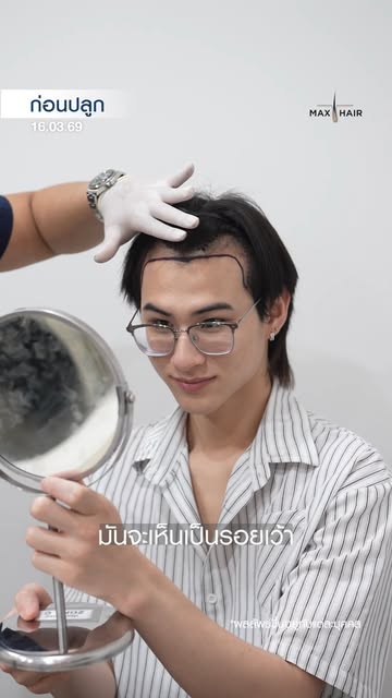 [ เอิร์ธ กันตโชติ - ดารานักแสดง ] “ผมคิดว่าถ้าเริ่มเห็นว่าผมบาง ก็ควรดูแลตั้งแต่เนิ่น ๆ ครับ ยิ่งอาย