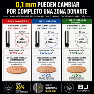 ¿Puede una diferencia de solo 0,1 mm cambiar una zona donante?

Durante años hemos hablado del diáme