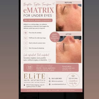 ✨ Your under-eyes deserve attention too.

Fine lines, crepey texture, loss of firmness and uneven pi