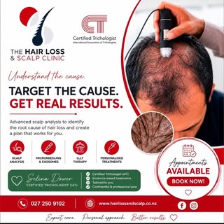 Worried about Hairloss . Book now Levin and Wellington dates. Or call 0272509102