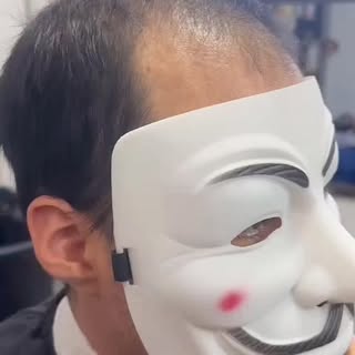 “La caída del cabello no define a nadie, pero recuperar tu imagen sí puede cambiar tu confianza para