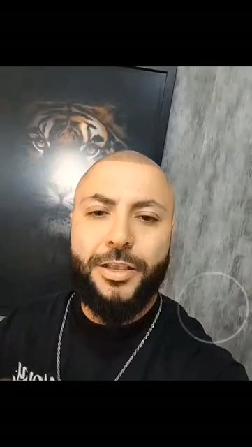 A calvície avançou e está afetando sua autoestima? 👨‍🦲

A Micropigmentação Capilar pode ser uma al