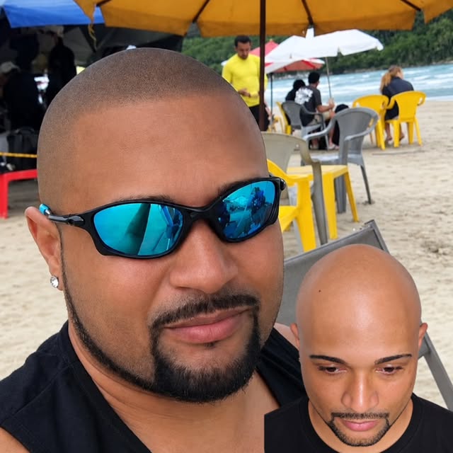 Estética ou vaidade 

Cuidado próprio 

Qualidade de vida 

Viver bem e feliz 

Micropigmentação cap