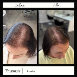 ✨ From see-through to solid ✨
This transformation is for anyone feeling self-conscious about thinnin