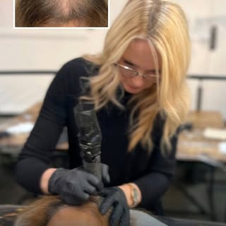 Finally, the scalp transformation you've dreamed of, without the worry! Our 30 years of expert scalp