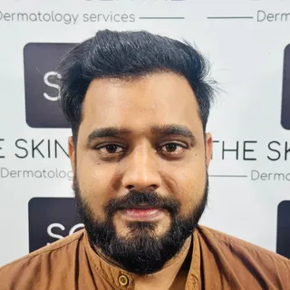 A 28 yr old patient who had tried everything for his hair regrowth ,finally trusted us for his hairl