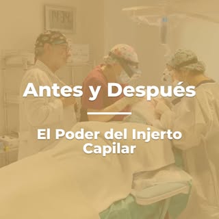 🔍🌟 Hoy venimos con otro impresionante cambio en Aslan. ¡No podrás creer la transformación que logr
