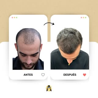 🪄 ¡Despedimos el año con una transformación espectacular!

🌿 ¡El Poder del Crecimiento Capilar!

E