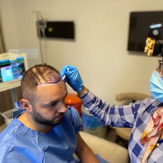 Before any hair transplant, we carefully plan the hairline and conduct thorough pre-op tests, includ