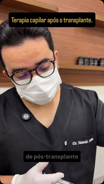 A mesoterapia capilar é um tratamento complementar para calvície, podendo ser realizada antes e após