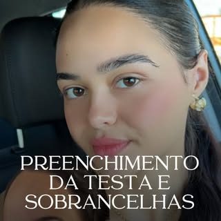 A Fabiana buscava duas mudanças importantes: encurtar a testa e recuperar a densidade natural das so