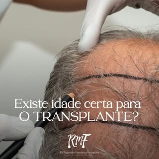 Uma das perguntas mais frequentes no consultório é: existe uma idade ideal para fazer transplante ca