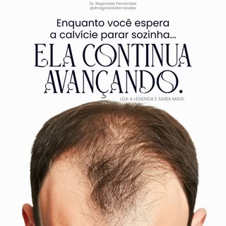 A calvície não costuma estabilizar sem tratamento. Enquanto você adia a avaliação, os fios continuam