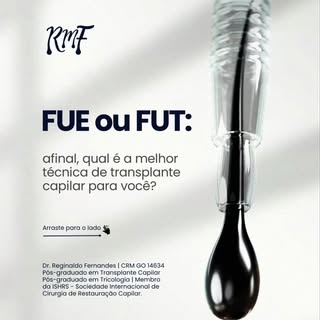 A melhor técnica não é a mais famosa, e sim a que atende às características do seu caso. Tanto a FUE