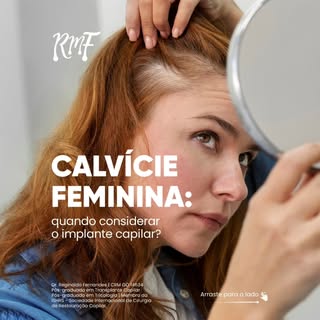 A calvície feminina pode causar afinamento progressivo dos fios, principalmente na região superior d
