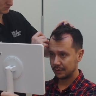 Comment “grow” for The Ultimate Hair Loss Guide! 🚀#hairtransplant #hairtransformation #haircut #hai