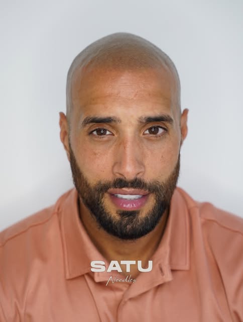 BEFORE → AFTER

Look at this amazing transformation! 🔥

From a receding hairline to a brand-new, na