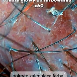 #włosy #skóragłowy #skin #beauty