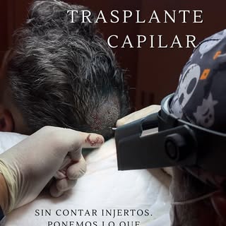 ¿Estás cansado de perder pelo y no encontrar soluciones que realmente funcionen?
Soy el Dr. Ariel, c
