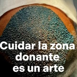 🩺 En este caso especial, el Dr. Ariel Cotignola explica cómo una correcta planificación y experienc