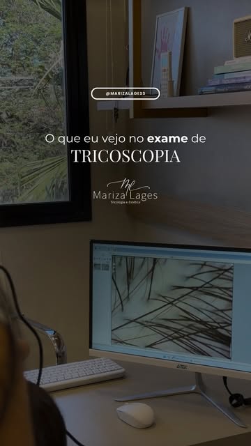 A tricoscopia mostra o que o espelho não vê.

Ela ajuda a identificar sinais nos fios e no couro cab